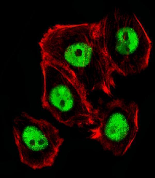 Fluorescent image of A431 cells stained with Mouse Ctr9 Antibody (C-term)
