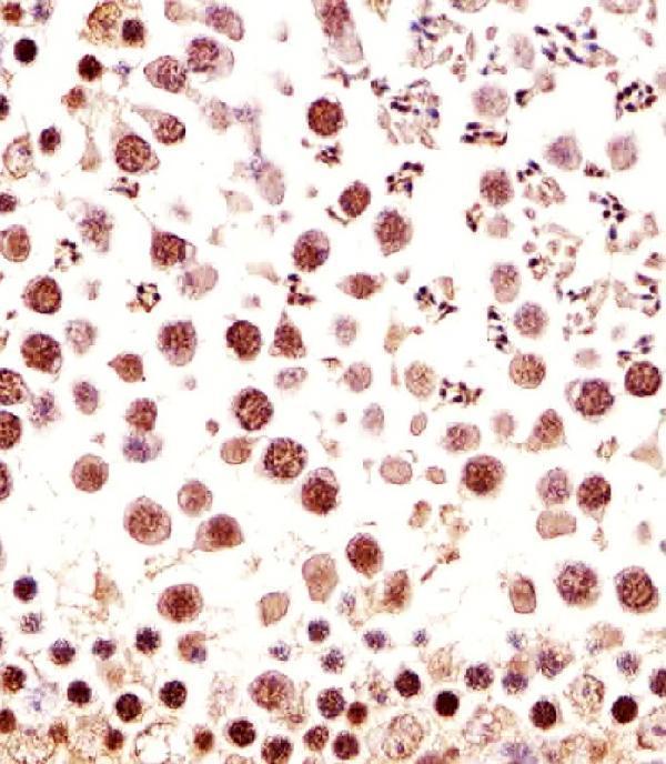 Immunohistochemical analysis of paraffin-embedded M