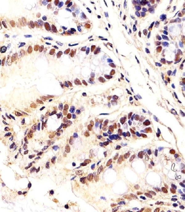 a05192 anti mouse ctr9 antibody c term ihc p testing 4
