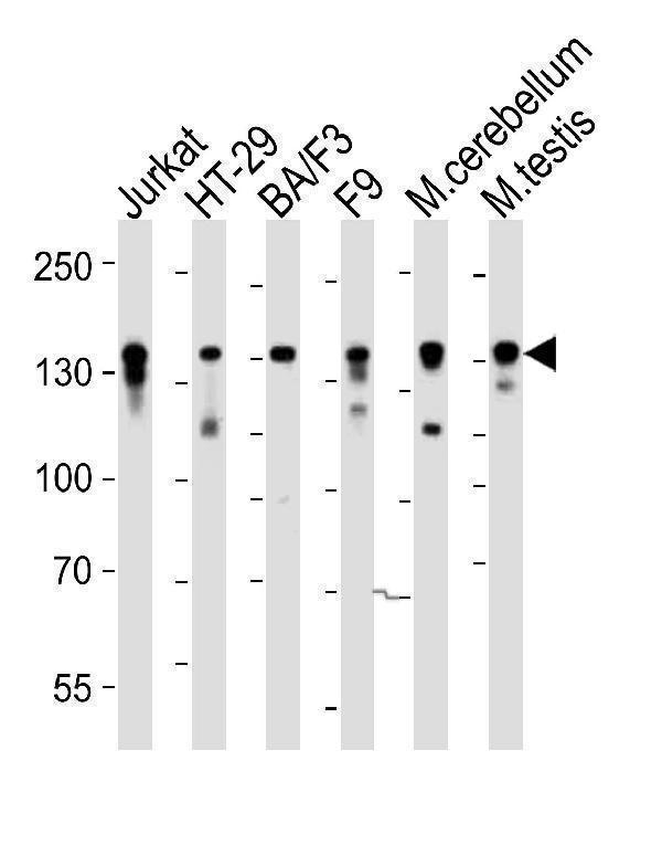 Western blot analysis of lysates from Jurkat, HT-29, mouse BA/F3, mouse F9 cell line, mouse cerebellum, mouse testis tissue (from left to right), using Mouse Ctr9 Antibody (C-term) (Cat