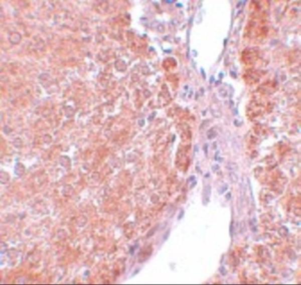 Immunohistochemistry of SUMO2/3 in rat liver tissue with SUMO2/3 antibody at 5 μg/mL