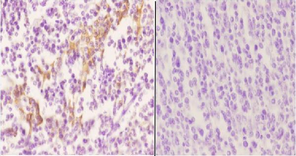 a05197 rgs10 primary antiboties ihc testing 2