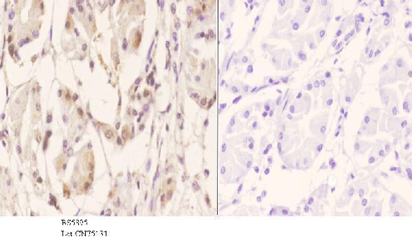 a05197 rgs10 primary antiboties ihc testing 3