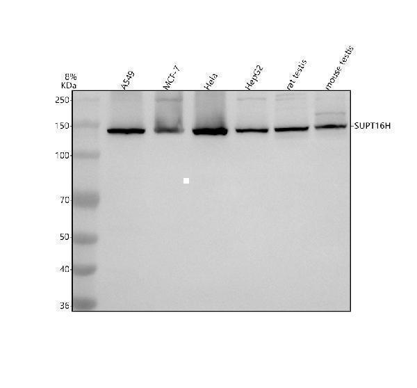 Western blot analysis of SUPT16H using anti-SUPT16H antibody (A05199-1)