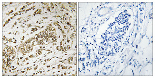 Immunohistochemistry validation of SUPT16H using Anti-SPT16 SUPT16H Antibody (A05199)