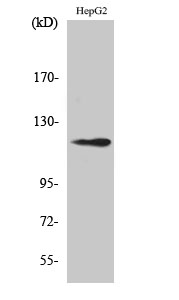 Western blotting validation for Anti-SPT16 SUPT16H Antibody A05199
Western Blot (WB) analysis of specific cells using SPT16 polyclonal antibody