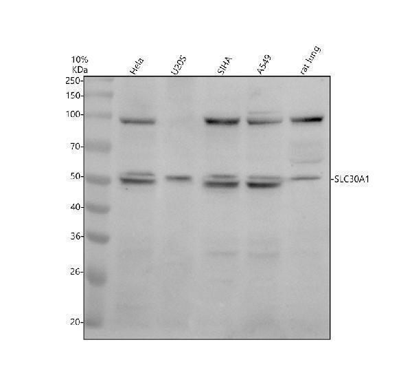 Western blot analysis of SLC30A1 using anti-SLC30A1 antibody (A05201-1)