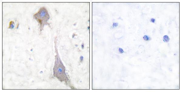 a05202 grm7 primary antibodies ihc testing 1