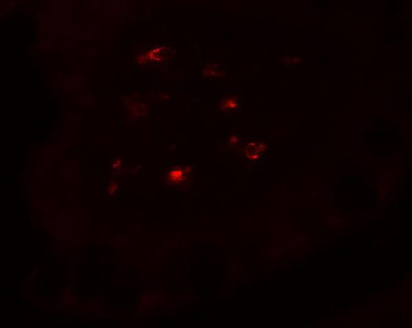 Immunofluorescence of CTHRC1 in human small intestine tissue with CTHRC1 antibody at 20 μg/mL