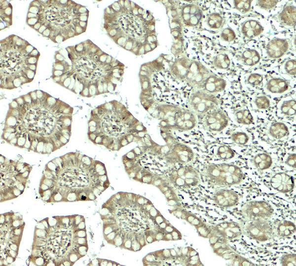 Immunohistochemistry of CTHRC1 in human small intestine tissue with CTHRC1 antibody at 5 μg/mL