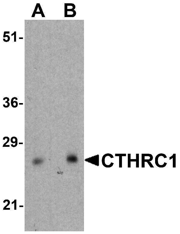 Western blot analysis of CTHRC1 in rat small intestine tissue lysate with CTHRC1 antibody at (A) 1 and (B) 2 μg/ml