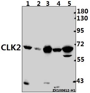 Western blot (WB) analysis of CLK2 (R15) pAb at 1:500 dilution
Lane1:C6 whole cell lysate(40ug)
Lane2:3T3-L1 whole cell lysate(40ug)
Lane3:HuT78 whole cell lysate(40ug)
Lane4:Hela whole cell lysate(30ug)
Lane5:A375 whole cell lysate(40ug)