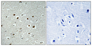 a05206 clk2 primary antibodies ihc testing 1