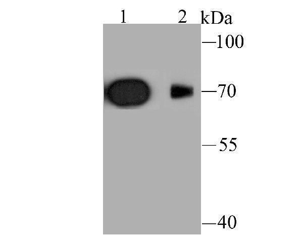 Western blot analysis of Kv1