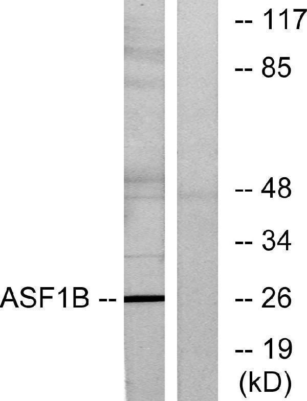 Western blot analysis of lysates from K562 cells, using ASF1B Antibody