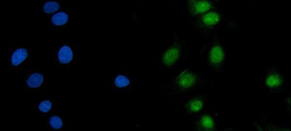  IF analysis of ASF1B using anti-ASF1B antibody (A05211-2)