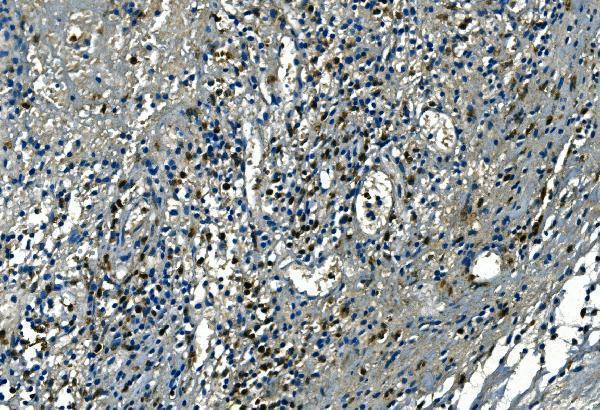  IHC analysis of Azurocidin/AZU1 using anti-Azurocidin/AZU1 antibody (A05212-1)