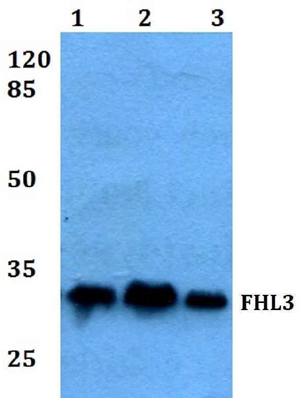 Western blot (WB) analysis of FHL3 polyclonal antibody at 1:500 dilution
Lane1:Hela whole cell lysate
Lane2:Raw264