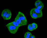 ICC staining HDAC10 in Hela cells (green)