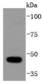 Western blot analysis of HDAC10 on HepG2 cells lysates using anti-HDAC10 antibody at 1/1,000 dilution