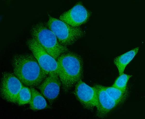 a05217 1 fkbp10 primary antibodies if testing 2