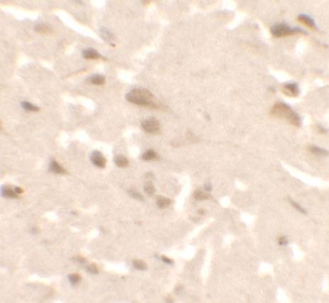 a05219 1 ulk2 primary antibodies ihc testing 2