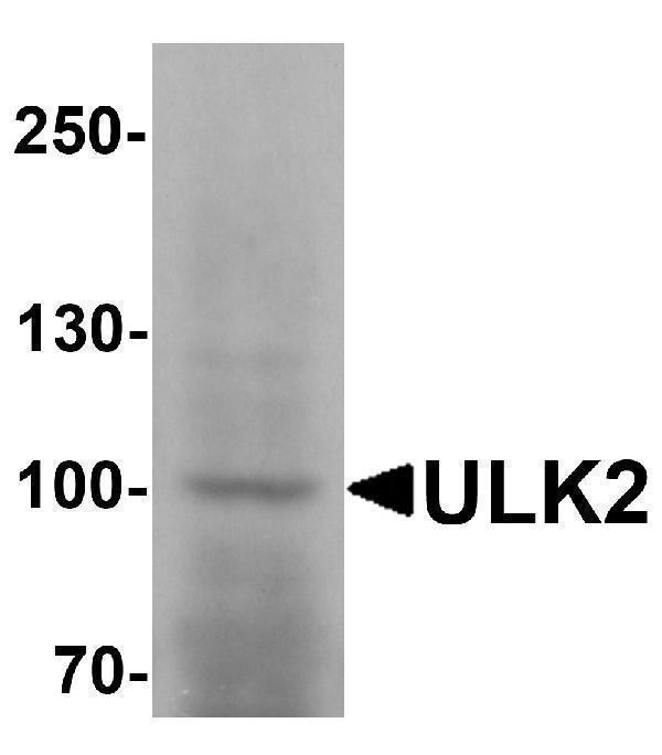 a05219 1 ulk2 primary antibodies wb testing 1