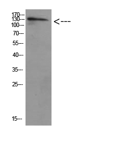 a05219 ulk2 primary antibodies wb testing 1