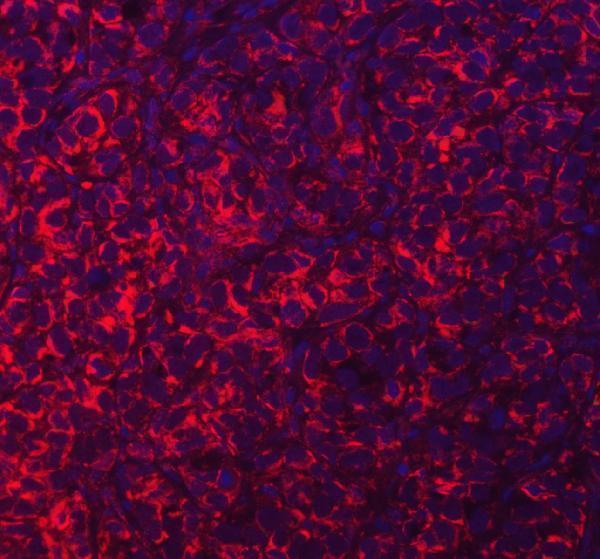 a05223 3 acad9 primary antibodies if testing 8