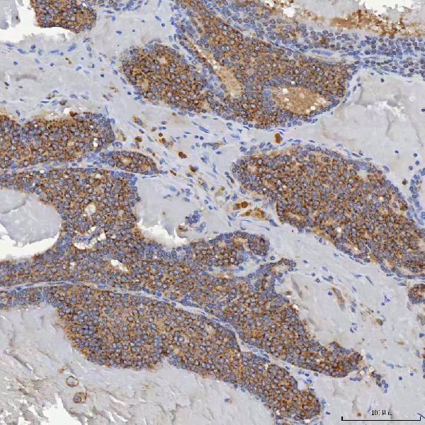  IHC analysis of ACAD9 using anti-ACAD9 antibody (A05223-3)
