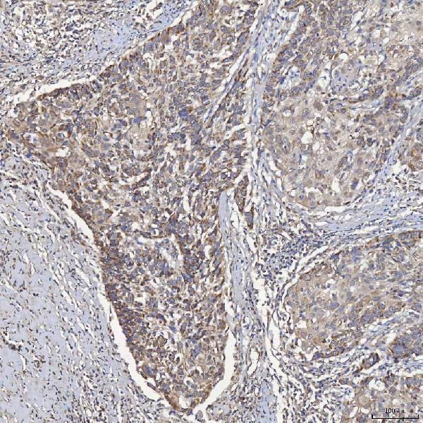 IHC analysis of ACAD9 using anti-ACAD9 antibody (A05223-3)