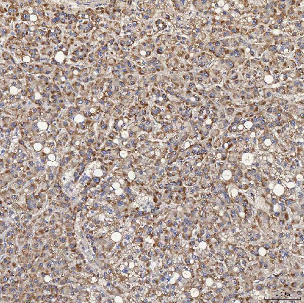 a05223 3 acad9 primary antibodies ihc testing 4