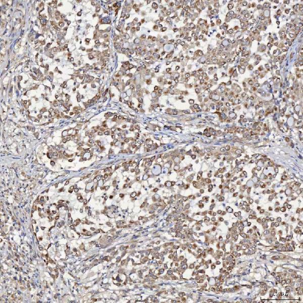 a05223 3 acad9 primary antibodies ihc testing 5