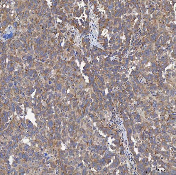a05223 3 acad9 primary antibodies ihc testing 6