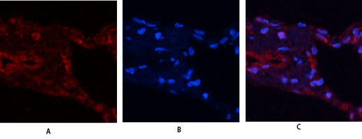 Immunofluorescence analysis of human-lung tissue