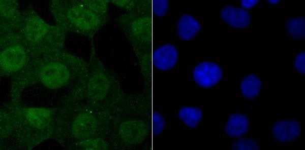 ICC staining USP11 in A549 cells (green)