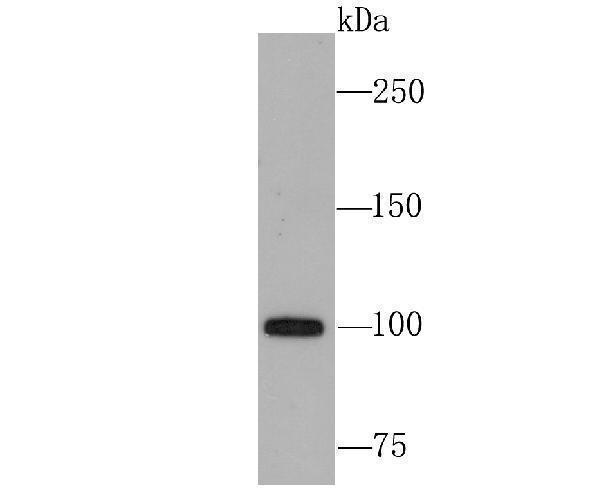 Western blot analysis of USP11 on 293T cell using anti-USP11 antibody at 1/1,000 dilution