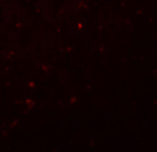 Immunofluorescence of IKZF2 in human spleen tissue with IKZF2 antibody at 20 μg/mL