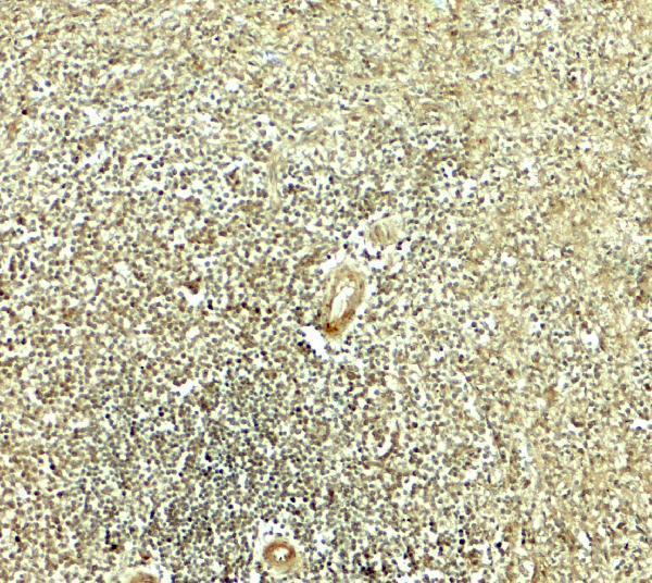 Immunohistochemistry of IKZF2 in human spleen tissue with IKZF2 antibody at 5 μg/mL