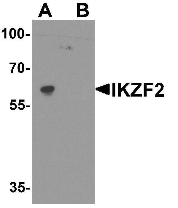 Western blot analysis of IKZF2 in EL4 cell lysate with IKZF2 antibody at 1 μg/ml in (A) the absence and (B) the presence of blocking peptide
