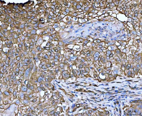 a05231 1 lima1 primary antibodies ihc testing 2