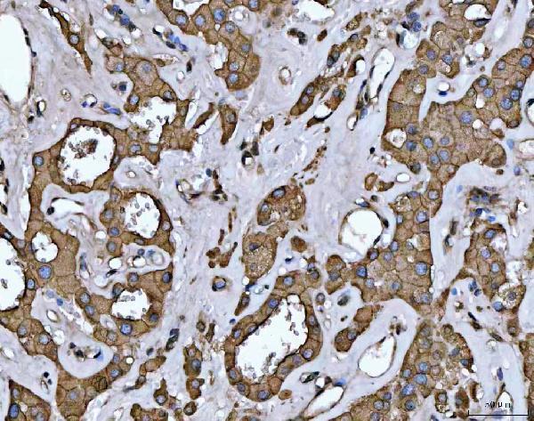 a05231 1 lima1 primary antibodies ihc testing 3