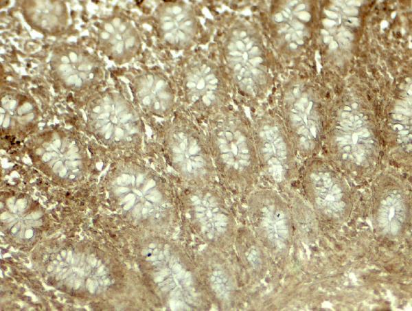 a05231 lima1 primary antibodies ihc testing 2