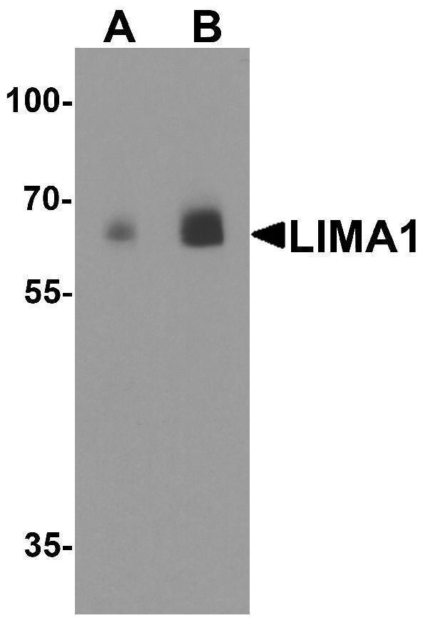 a05231 lima1 primary antibodies wb testing 1