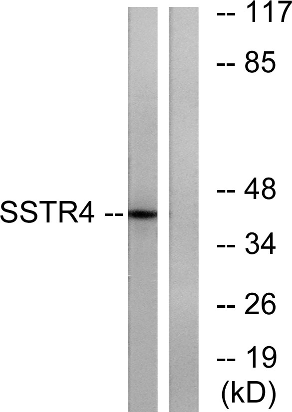 Western blot analysis of lysates from LOVO cells, using SSTR4 Antibody