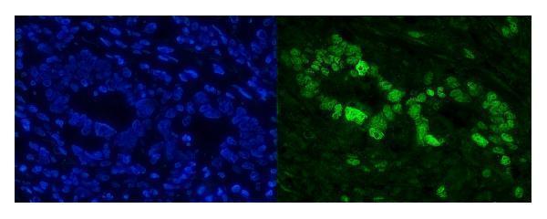 a05234 2 cbx8 primary antibodies if testing 5