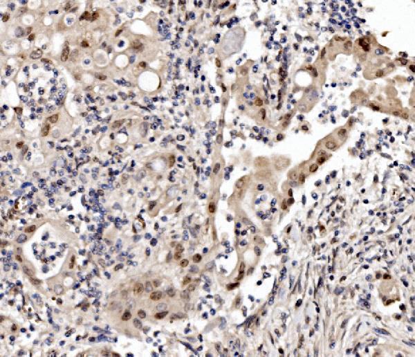 a05234 2 cbx8 primary antibodies ihc testing 2