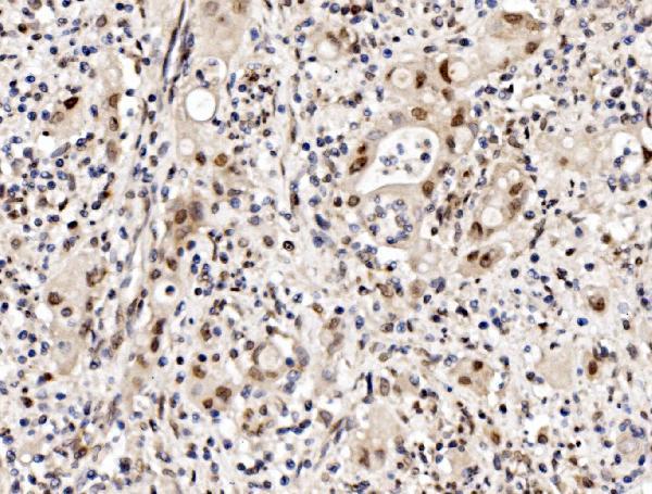 a05234 2 cbx8 primary antibodies ihc testing 3