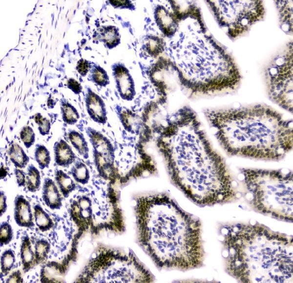 a05234 2 cbx8 primary antibodies ihc testing 7