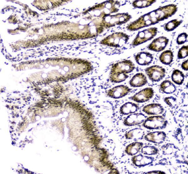 a05234 2 cbx8 primary antibodies ihc testing 8